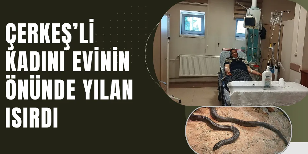 ÇERKEŞ’Lİ KADINI EVİNİN ÖNÜNDE YILAN ISIRDI
